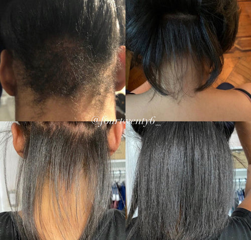 Herbal Extra Strength Hair Growth Oil w/ Rare Batana & 15-Herb Infusion