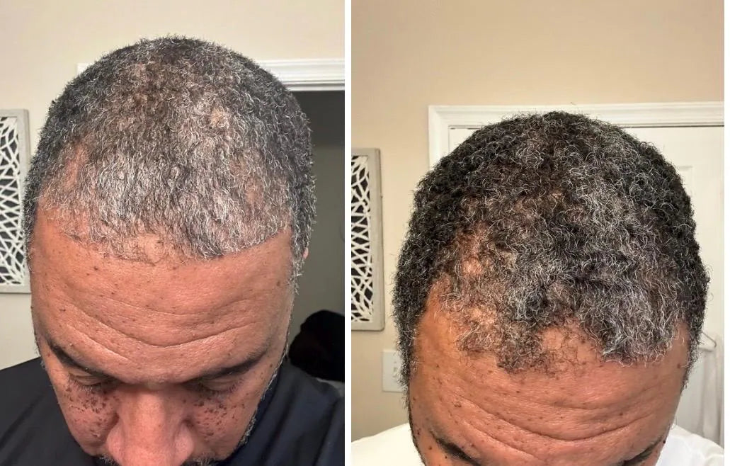Herbal Rosemary + Hibiscus Extra Strength Hair Growth Oil