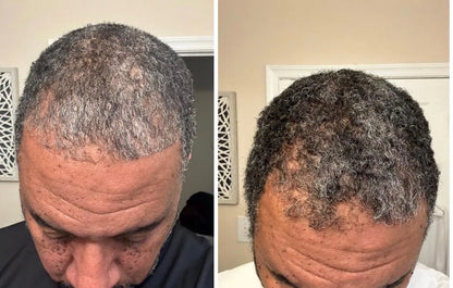 Herbal Rosemary + Hibiscus Extra Strength Hair Growth Oil
